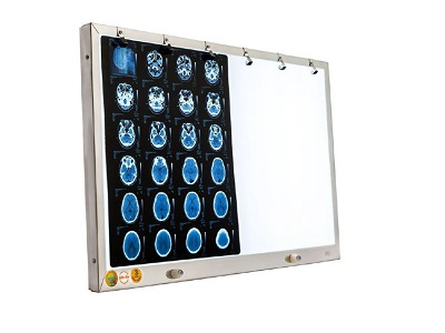 Đèn đọc phim y khoa Led