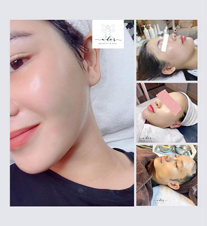 Liệu Trình Chăm Sóc Da GLOWSKIN