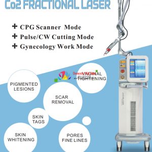 Máy laser trục khuỷu