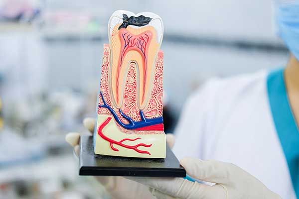 Trám răng