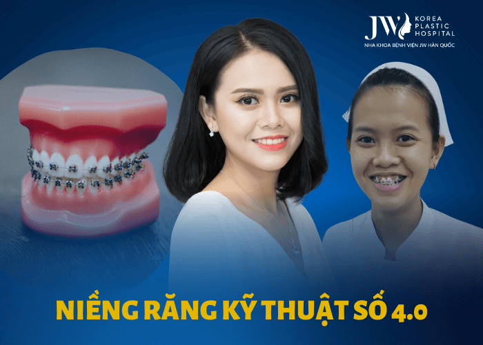 Niềng răng
