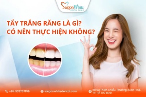 Tẩy Trắng Răng